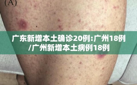 广东新增本土确诊20例:广州18例/广州新增本土病例18例
