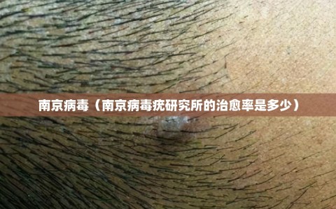 南京病毒（南京病毒疣研究所的治愈率是多少）
